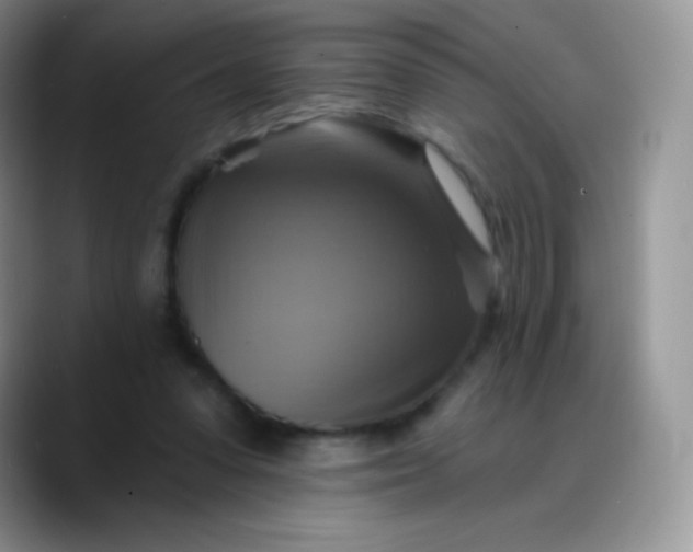 X0000088200303200705292038