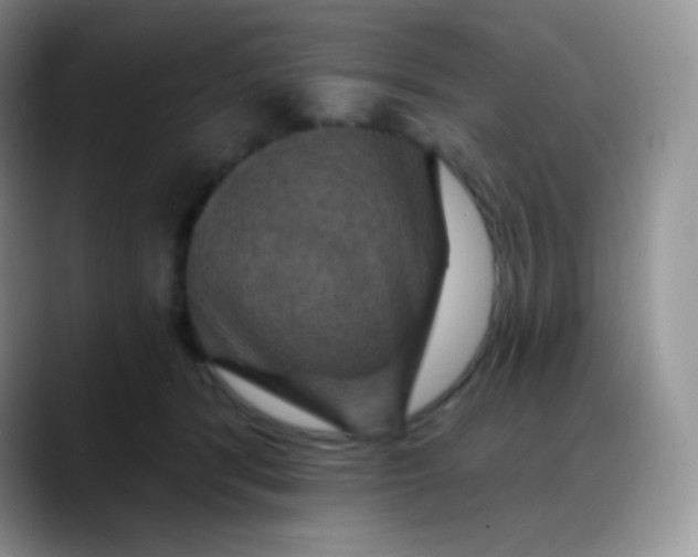 X0000088200416200705292036