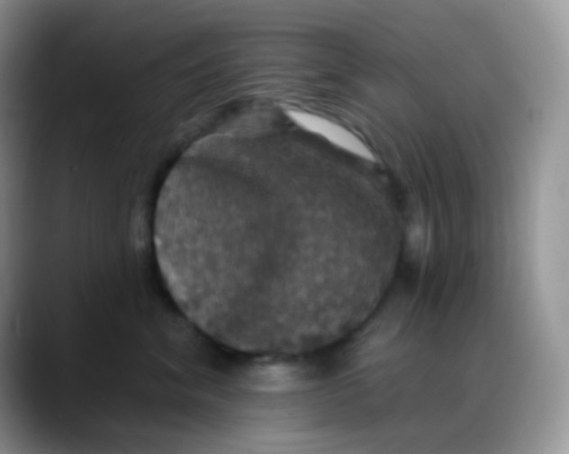 X0000088200620200705292034