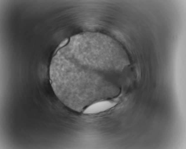 X0000088200964200705292029