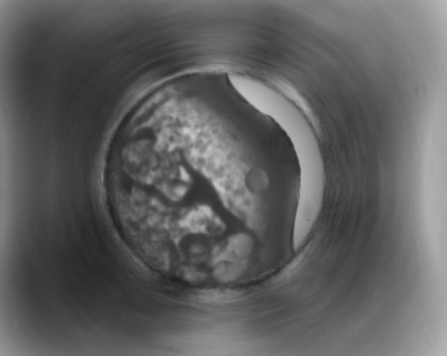 X0000088201091200705292027