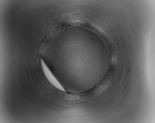X0000088201156200705292027