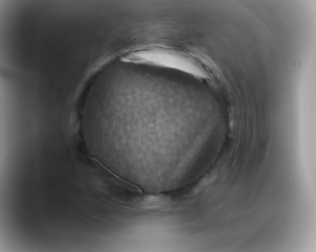 X0000088201160200705292026
