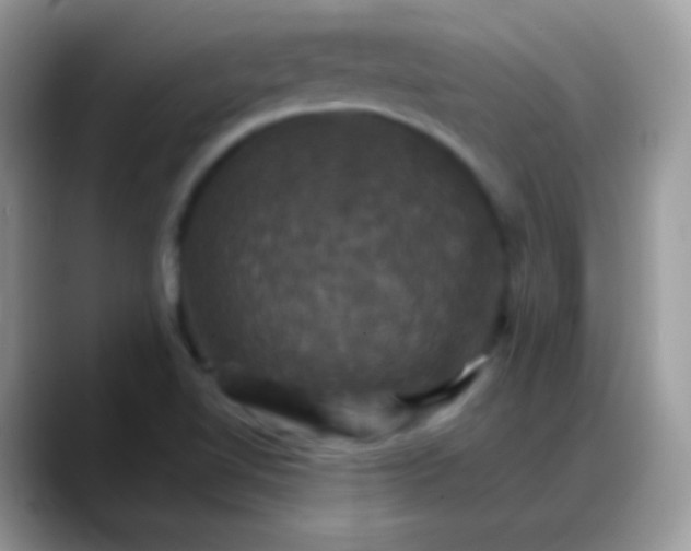 X0000088201510200705292022