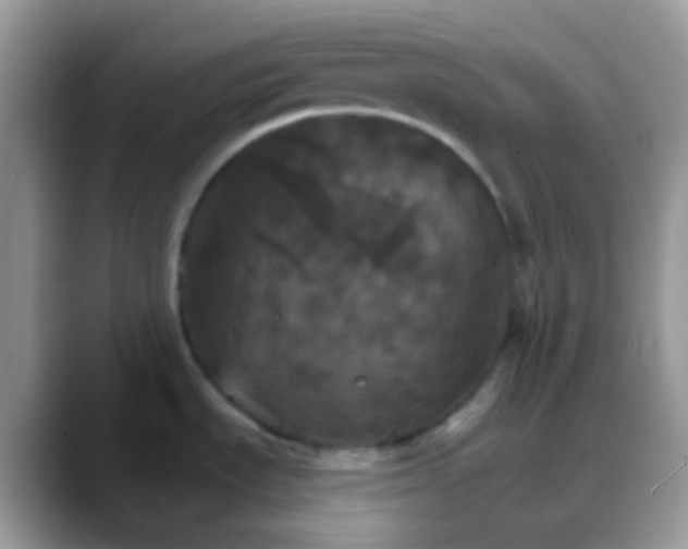 X0000088201535200705292022