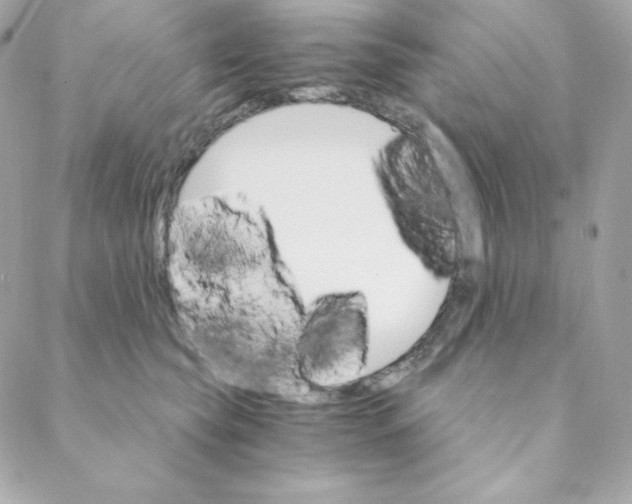 X0000088200565200706051235