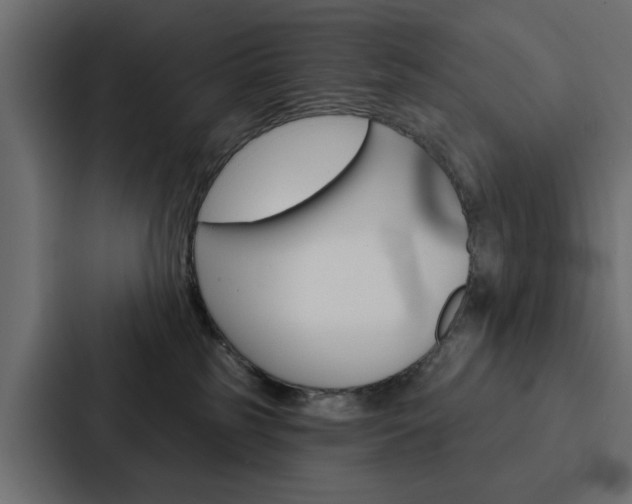 X0000088220185200705151036