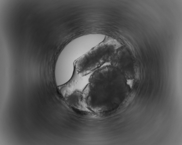 X0000088220569200705151031