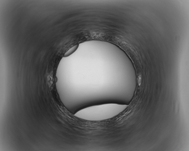 X0000088361011200705220728