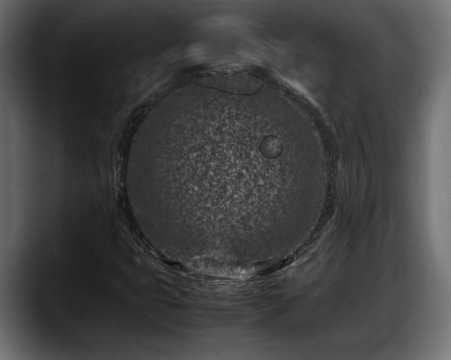 X0000088361399200705291258