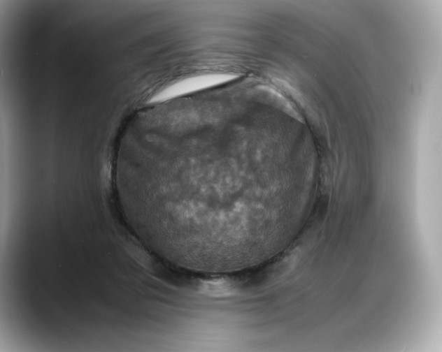 X0000088360309200706051028