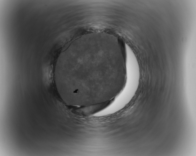 X0000088360818200706051021