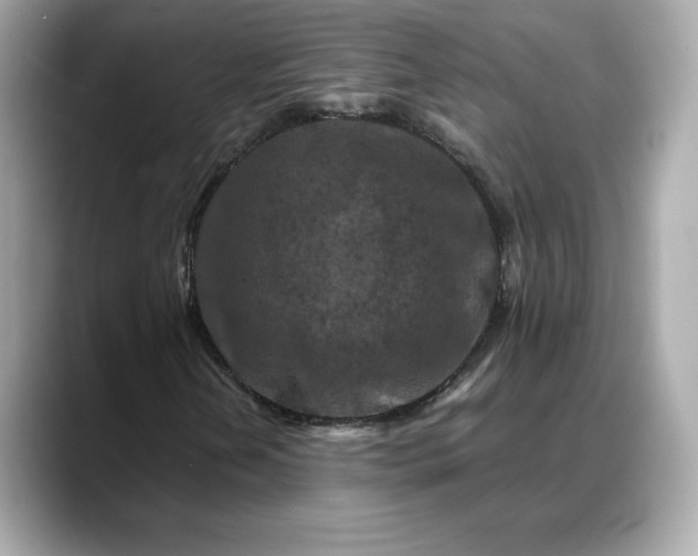 X0000088361202200706051017