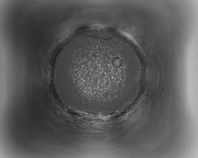 X0000088361399200706051015