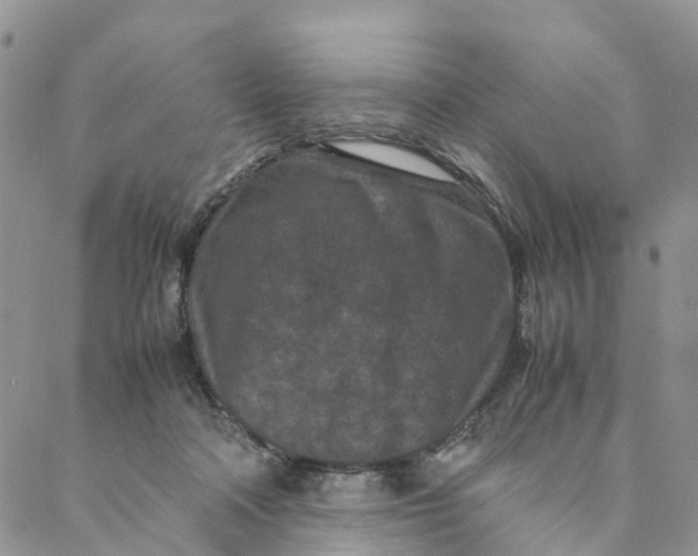 X0000088360314200706121102