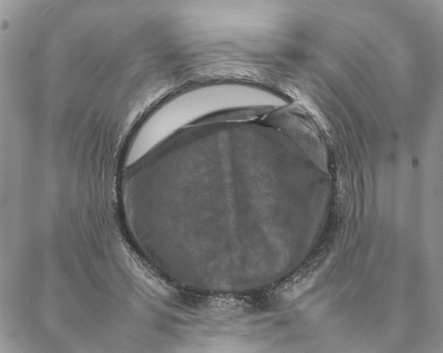 X0000088360399200706121100