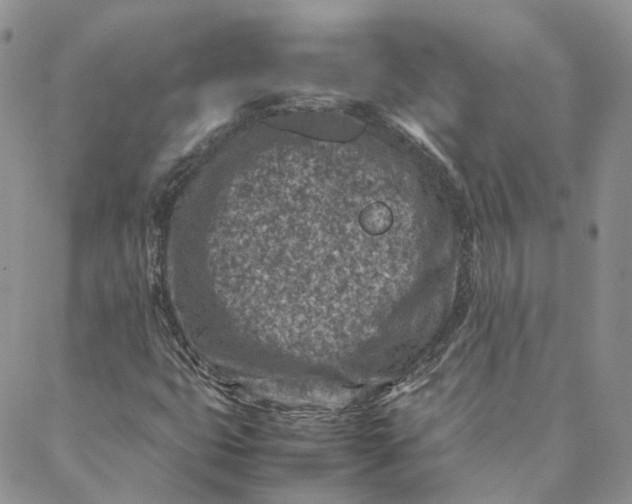 X0000088361399200706121043