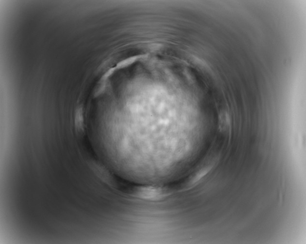 X0000088380238200706051105