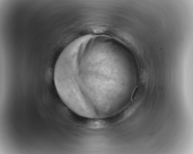 X0000088380321200706051104
