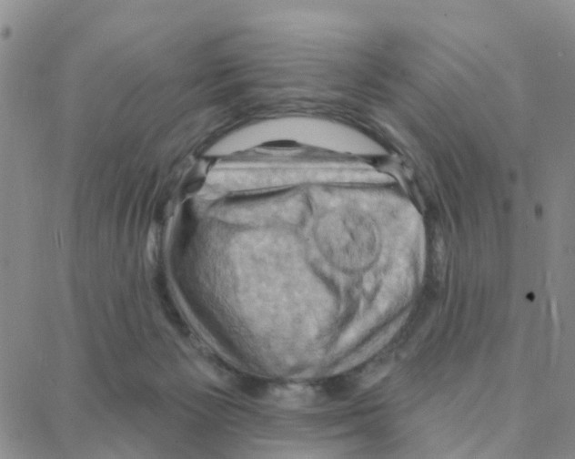 X0000088380125200706191317