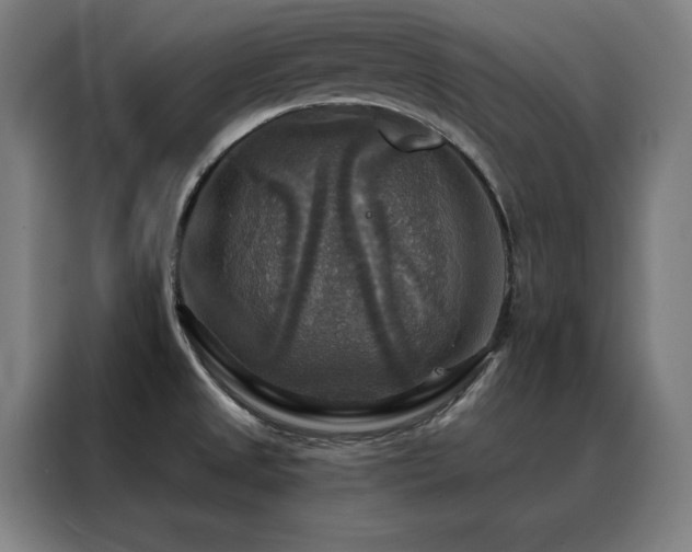 X0000088391525200705221104