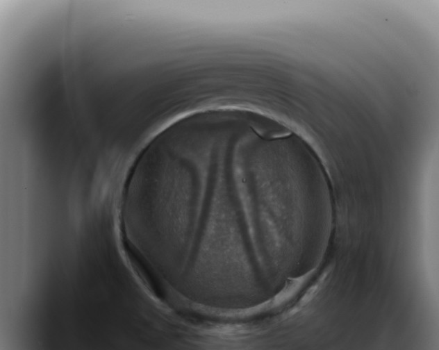 X0000088391525200705291358