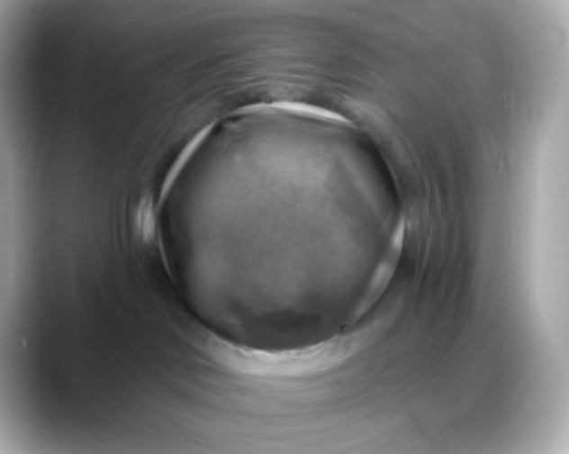 X0000088390046200706051125