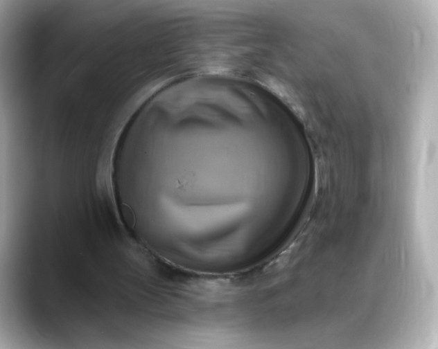 X0000088390147200706051123