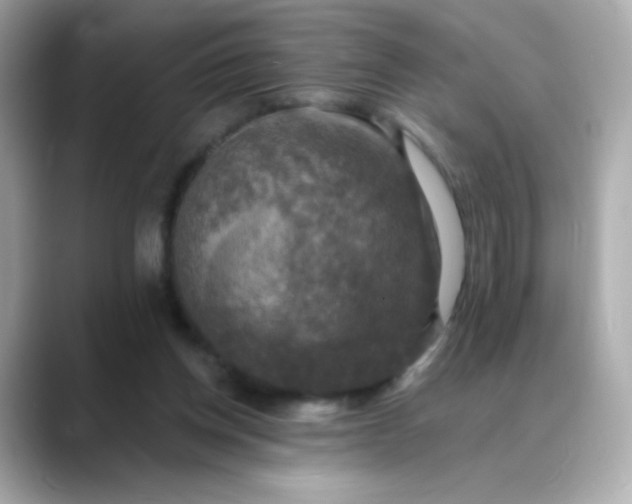 X0000088390158200706051124