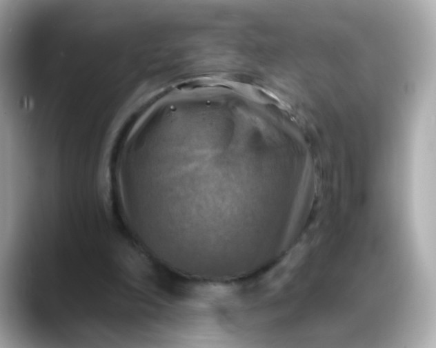 X0000088390198200706051123