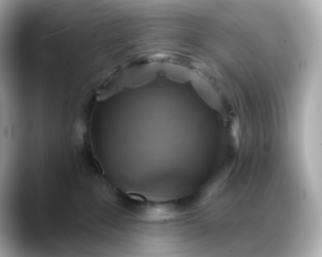 X0000088390235200706051123