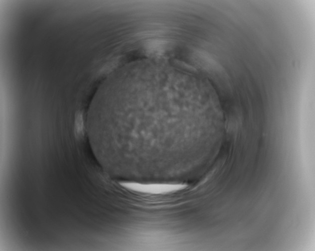 X0000088390335200706051122