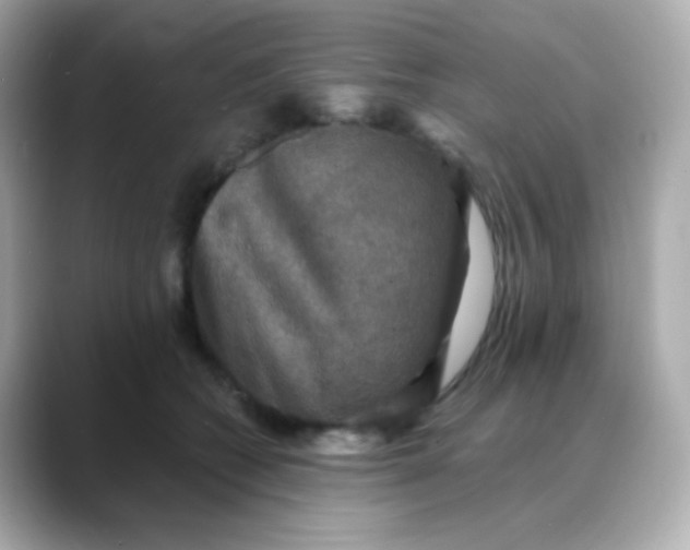 X0000088390562200706051119