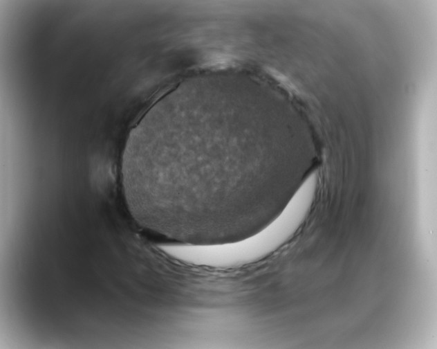 X0000088391206200706051111