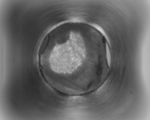 X0000088391335200706051110