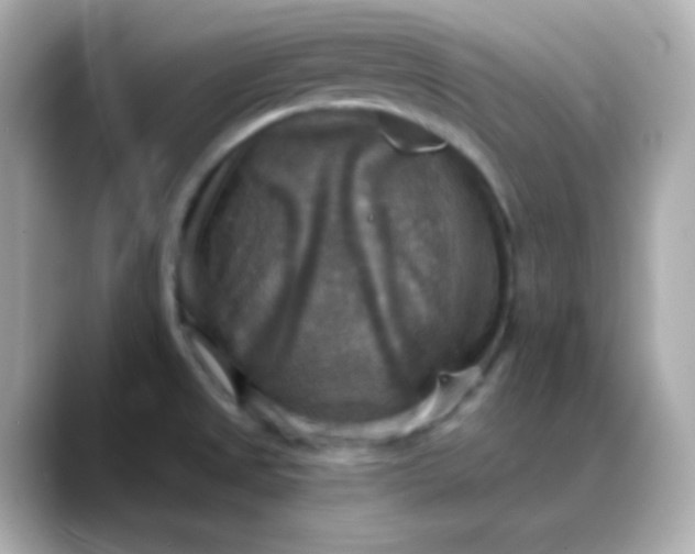 X0000088391525200706051108