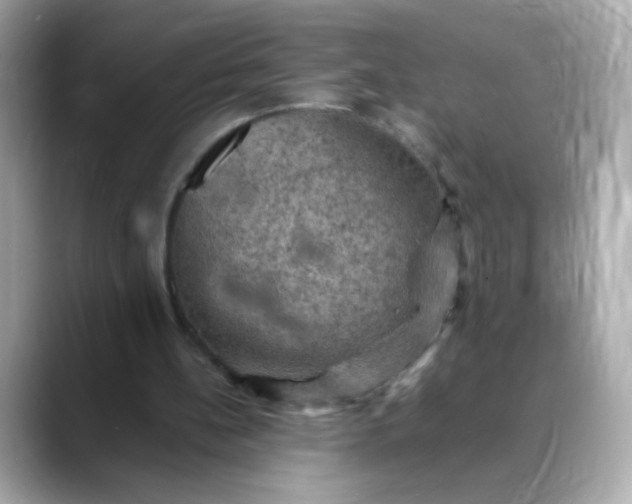 X0000088400148200706051142