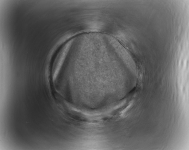 X0000088400244200706051141