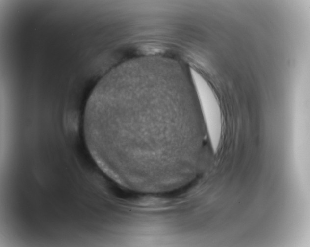 X0000088400315200706051140