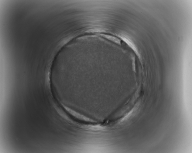 X0000088400389200706051139