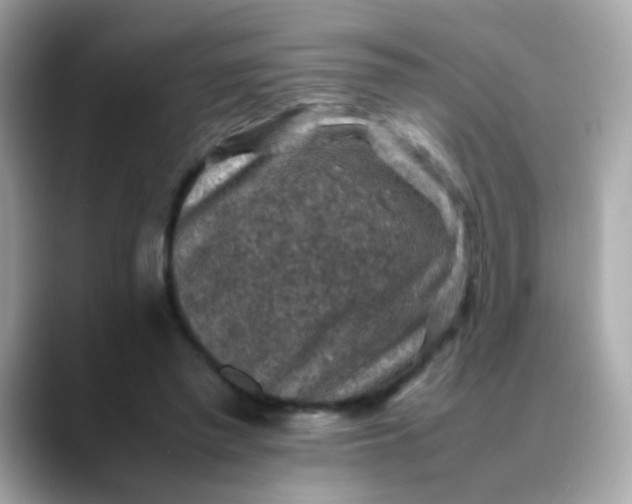 X0000088400397200706051139