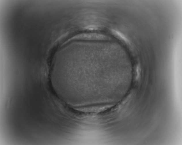 X0000088401158200706051130