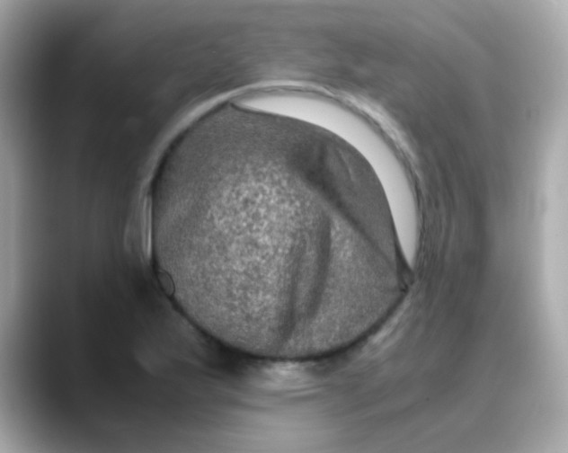 X0000088401175200706051130