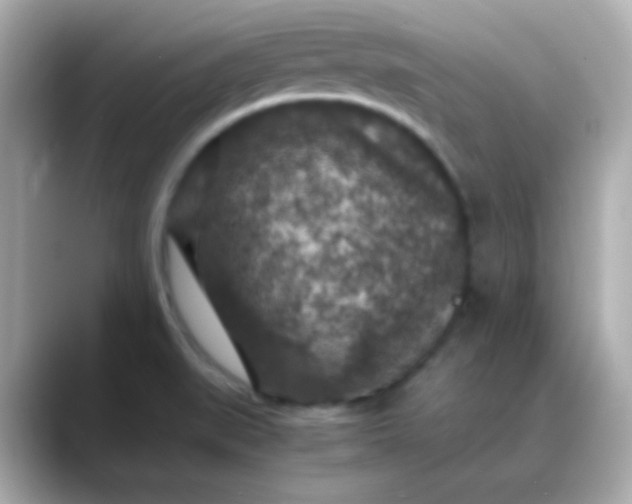 X0000088401519200706051126