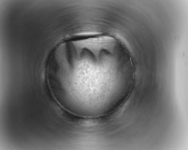 X0000088410305200706051158