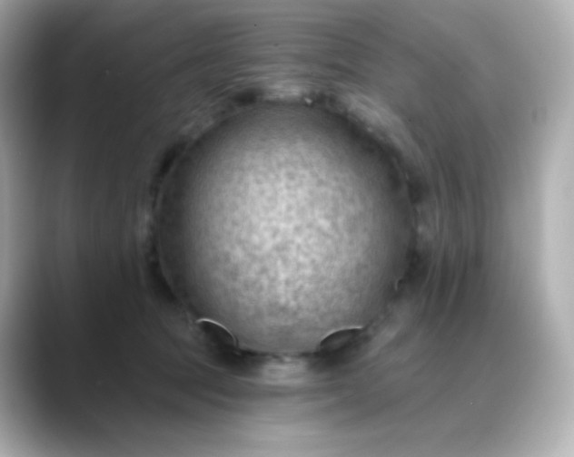 X0000088410369200706051158