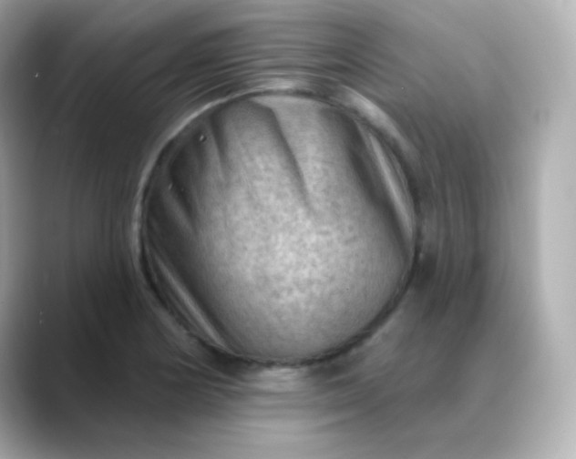 X0000088411178200706051148
