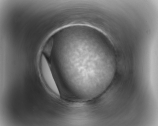 X0000088411519200706051144
