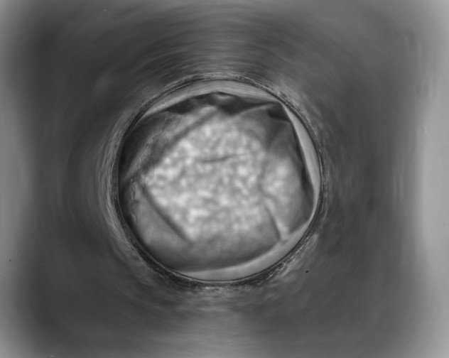 X0000088410145200706121420