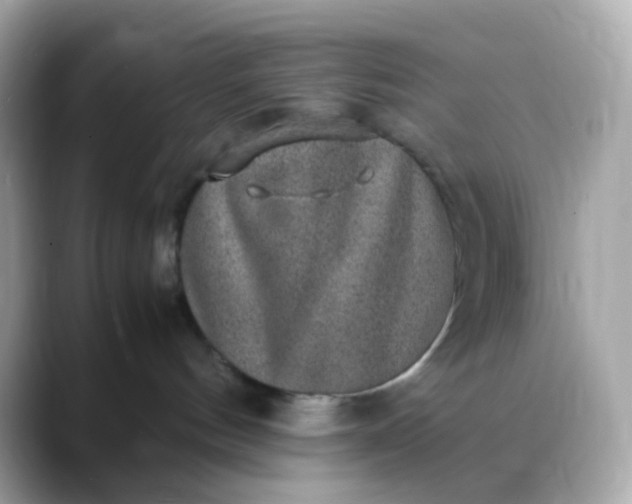 X0000088420144200706051218